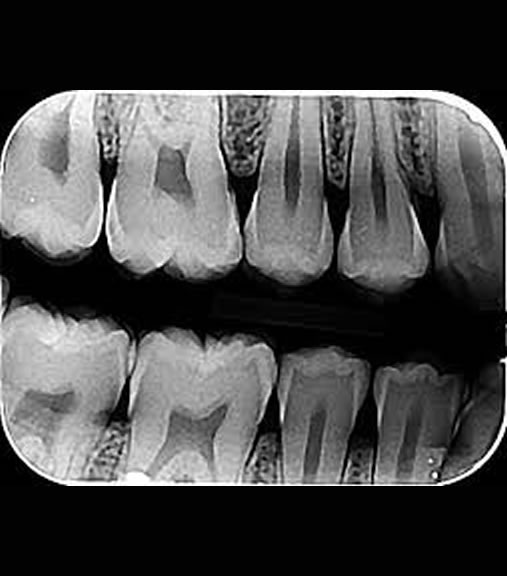 Radiografias e Tomografias – CDI Dental